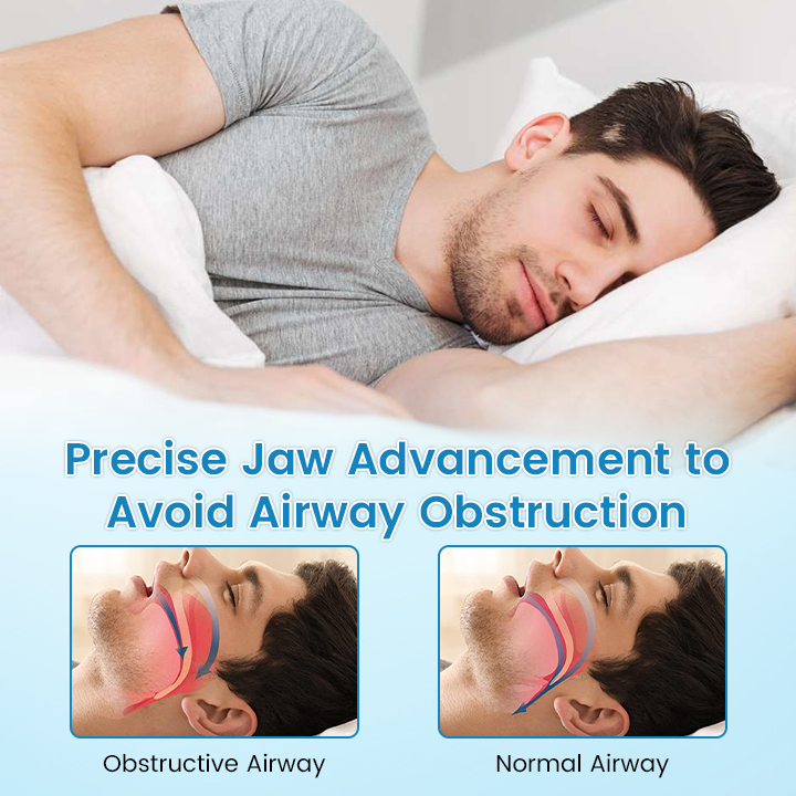 ✨JEREMYTIS™ Anti-Snoring & Anti-Grinding Teeth Protector