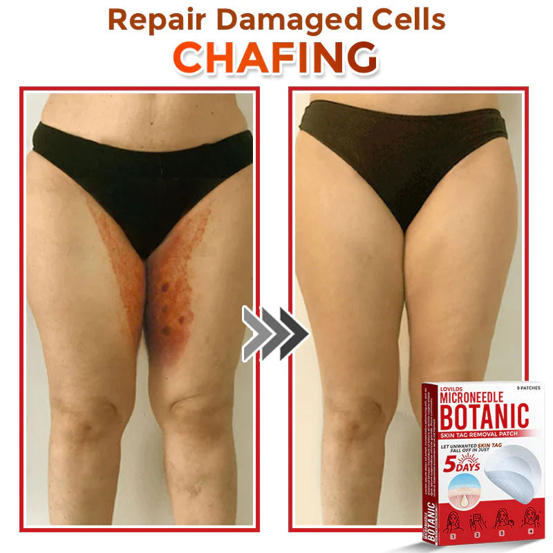 š MicroNeedle Botanic Skin Tag Removal Patch (Made in the USA)