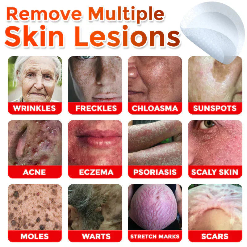 š MicroNeedle Botanic Skin Tag Removal Patch (Made in the USA)