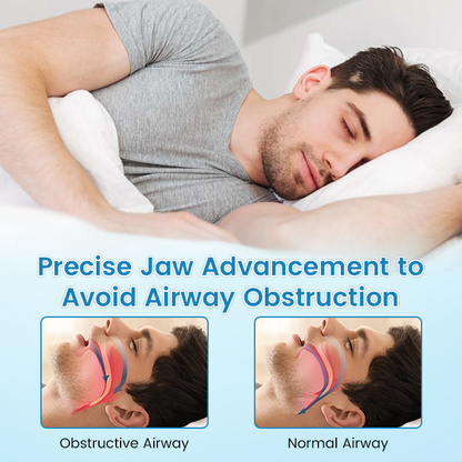 ✨JEREMYTIS™ Anti-Snoring & Anti-Grinding Teeth Protector
