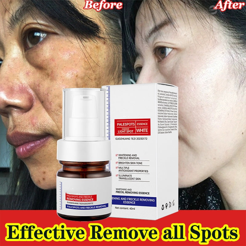 🔥FLASH SALE 50%：5-second brightening rescue: Dark spots disappear, blemishes fade, and skin becomes radiant! Vitamin C Whitening Freckles ESSENCE(3 HOURS LEFT!)